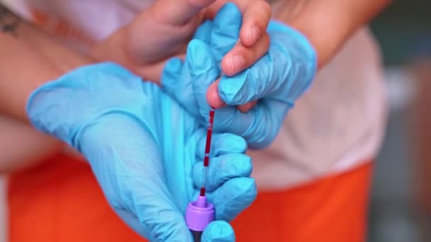 Medische medewerker neemt bloedmonster. Handen in het blauw steriele handschoenen verzamelen bloed uit de vinger van de patiënt. Een close-up. Bloedonderzoek. - Video