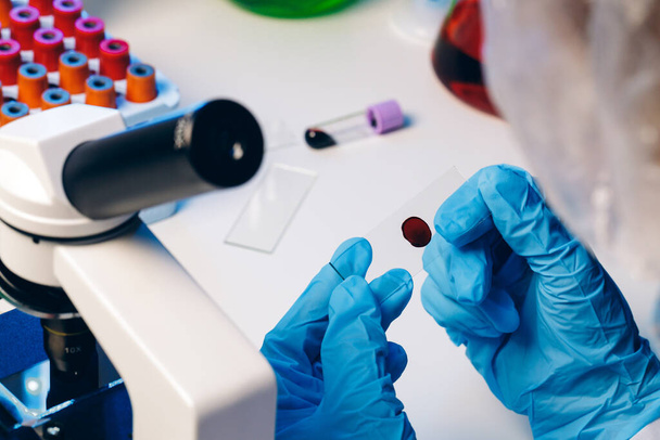 Hands of a laboratory worker doing blood test - Fotografie, Obrázek