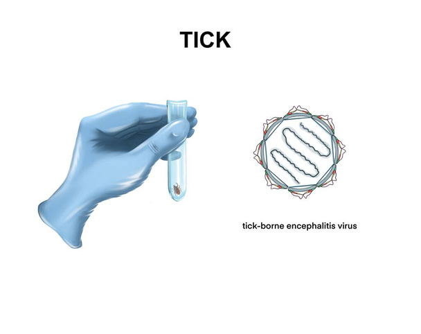 Illustration of the tick-borne encephalitis virus - Photo, Image