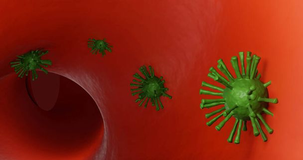 Corona Virüsü Hastalığı (COVID-19) tıbbi illüstrasyon enfeksiyonu. patojen solunum gribi virüsü hücreleri. Solunum sendromu olarak yerleşik hücreler salgını, viral zatürree semptomları. 3D. - Fotoğraf, Görsel