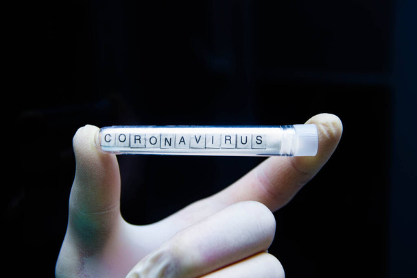 mano en guante sosteniendo tubo de ensayo médico con sangre positiva en covid19, concepto pandémico de prevención de la contaminación coronavirus  - Foto, Imagen