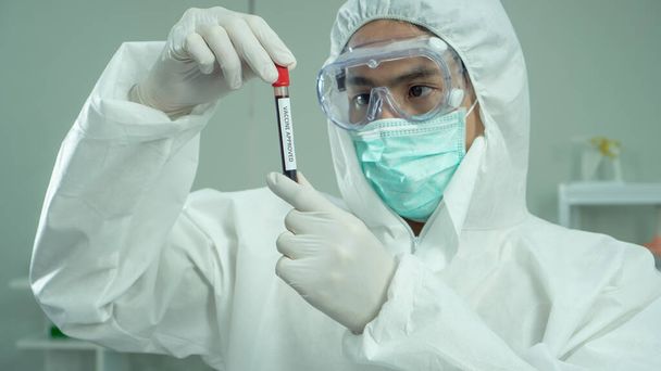 Pesquisadores estão inventando e testando drogas antirretrovirais. Num laboratório de alto nível seguro. Depois disso, o vírus foi examinado por um microscópio
. - Foto, Imagem