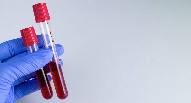 Primer plano de la mano del médico sosteniendo muestras de sangre tubos de ensayo. Banner médico con espacio de copia
 - Foto, Imagen