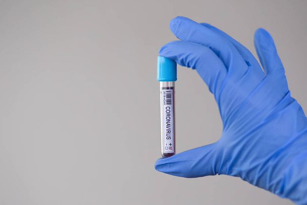 Blood sample of coronavirus test made in the world pandemic in 2020. Laboratory assistant holding blood sample for covid-19 test. - Photo, Image