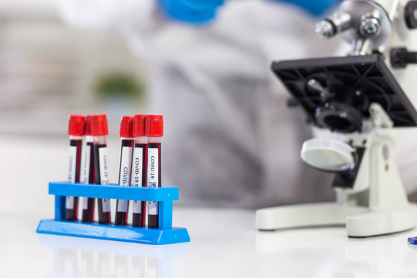 Rack van bloedbuizen met een label voor virusidentificatie wordt geplaatst voor een microbioloog die werkt in het laboratorium. - Foto, afbeelding