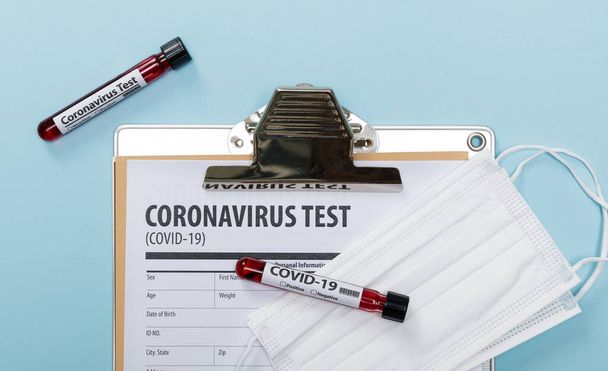 Coronavirus Salgını (COVID-19) için hastaların kan örneklerinin doktor tıbbi ekipmanları ile test edilmesi, Wuhan Çin konseptinden yeni koronavirüs 2019-nCoV, kopyalama alanı ile - Fotoğraf, Görsel