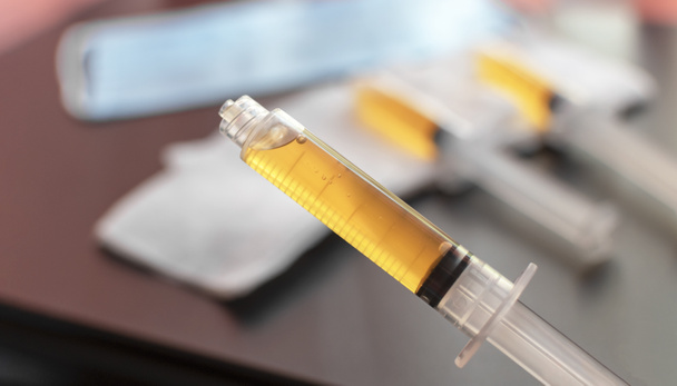 Blood plasma in a syringe on a blurred background. Blood plasma as a solution for the treatment of coronavirus. Platelet-rich plasma preparation for plasmolifting therapy. Selective focus. - Foto, afbeelding