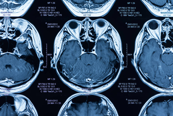 mágneses rezonancia kép, MRI vizsgálat az agy. - Fotó, kép