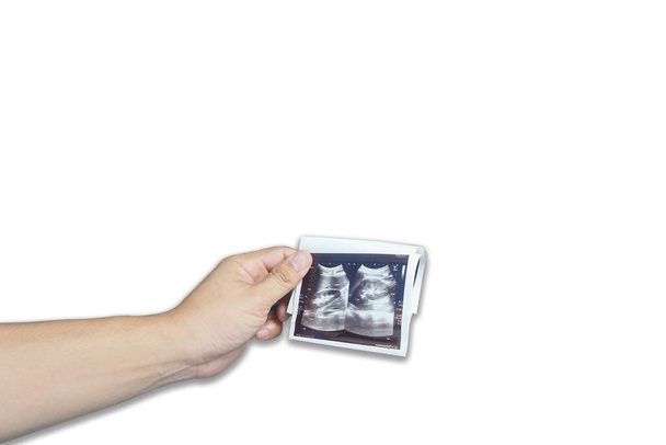 Lékař drží list s ultrazvukovým vyšetřením pro pacienta v pokoji.na bílém pozadí, koncept lékařského obrazu, selektivní zaměření. - Fotografie, Obrázek