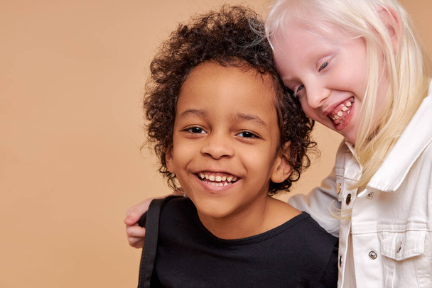 friendly children, tender african and albino kids - 写真・画像