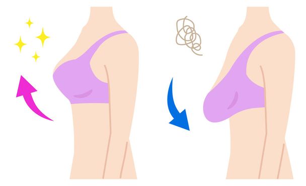 firm and sagging breasts illustration. womens beauty body care concept - Vector, Image