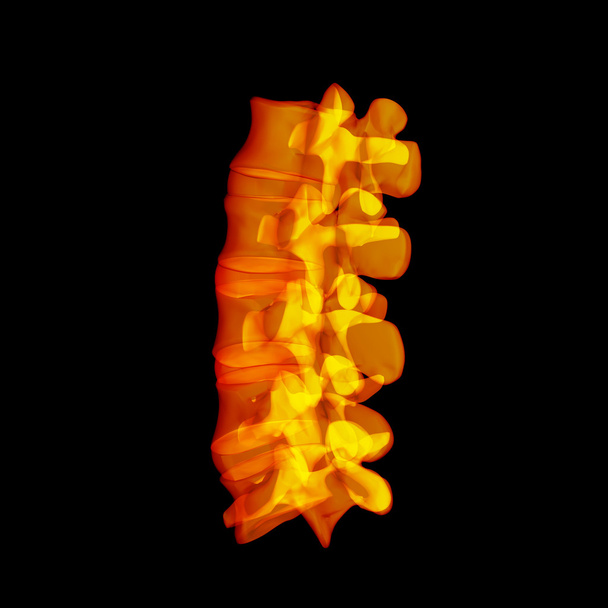 Humano con la columna vertebral
 - Foto, imagen