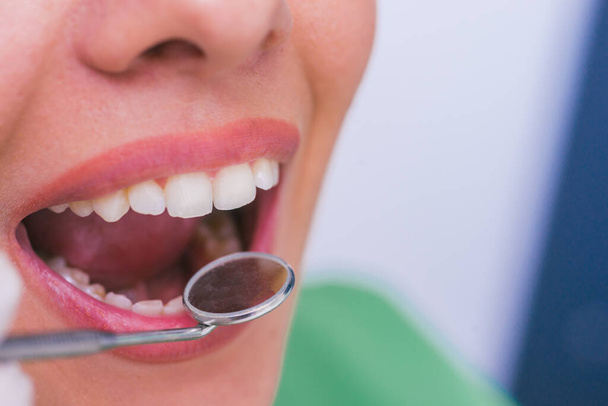 Closeup of a female patient with an open mouth during oral checkup at the dentist. - Фото, зображення