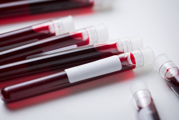 blood sample test tubes on white background , blood sample for COVID-19 test - Zdjęcie, obraz