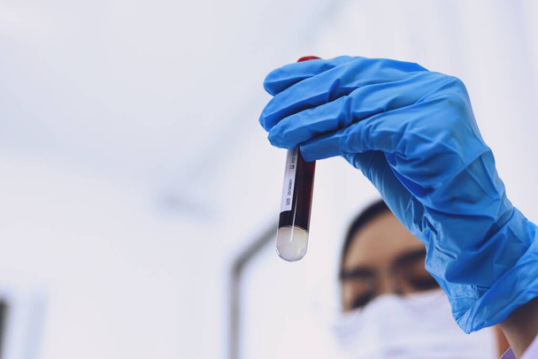 Vědec držící koronavirovou kovid-19 infikovanou zkumavku. DNA testování krve v laboratoři s odběrnými zkumavkami a injekční stříkačkou Coronavirus Covid-19 vakcinační výzkum - Fotografie, Obrázek