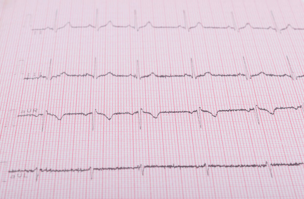 as background, cardiogram heartbeat, close-up - Photo, Image