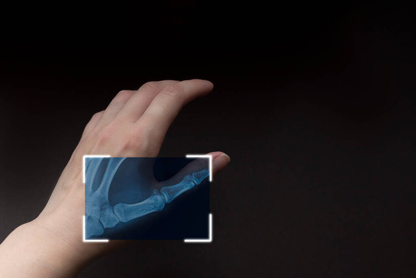 osittainen röntgenkuva käsi ruskea tausta, skannaus käsi, futuristinen teknologia biometriset. Kyberturvallisuusverkko - Valokuva, kuva