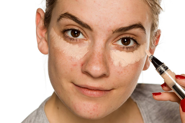 Young woman with problematic ckin applying concealer on white background - Foto, imagen