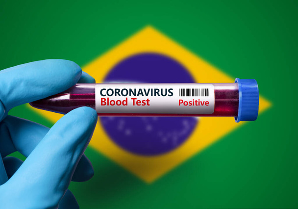 A test tube with a positive test for coronavirus against the background of the flag of   Brazil . COVID-19 concept for fighting the coronavirus epidemic in Brazil         - Foto, afbeelding