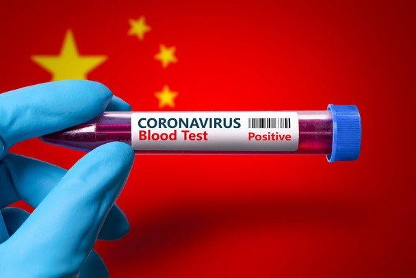 A test tube with a positive test for coronavirus against the background of the flag of China . COVID-19 concept for fighting the coronavirus epidemic in  China  - Photo, Image