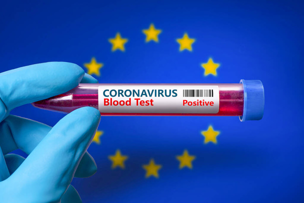 A test tube with a positive test for coronavirus against the background of the flag of.  European Union .COVID-19 concept for fighting the coronavirus epidemic in European Union - Foto, afbeelding
