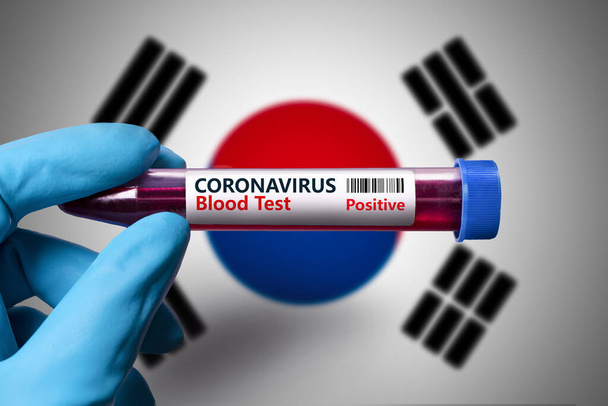 A test tube with a positive test for coronavirus against the background of the flag of. South Korea.  COVID-19 concept for fighting the coronavirus epidemic in South Korea - Foto, afbeelding