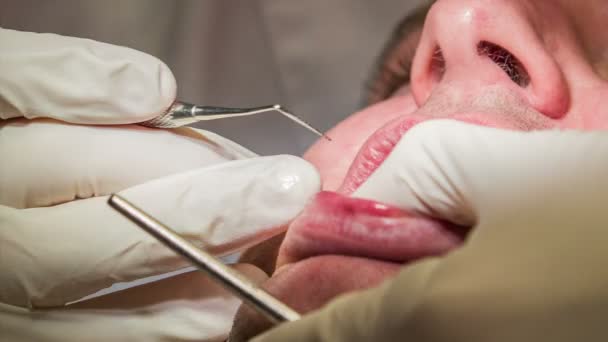 οδοντίατρος αρχίζει για τη θεραπεία του ασθενούς οδοντιατρική δόντια με μικρή βοήθεια του βοηθού - Πλάνα, βίντεο