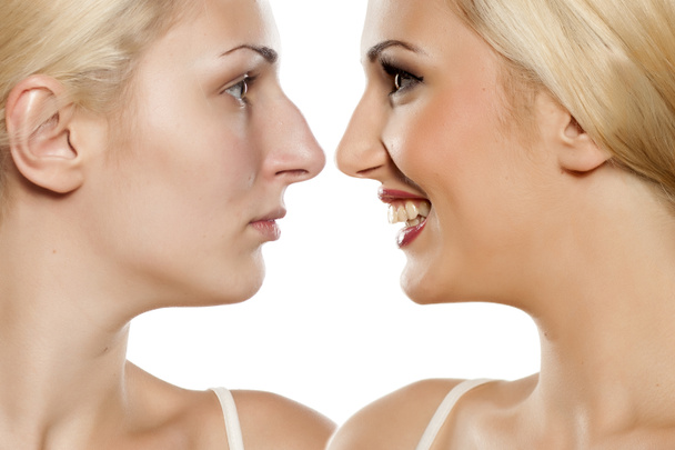 Egy fiatal nő profilja orrplasztika előtt és után - Fotó, kép