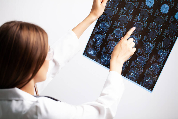 A young doctor examines an MRI image of a patient - Zdjęcie, obraz