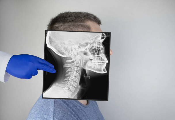 Onderzoek radiografie van een mannenschedel op de zijkant. Een dokter radioloog bestudeert een röntgenonderzoek. Een momentopname van de schedel wordt geplaatst op het hoofd van de patiënt - Foto, afbeelding