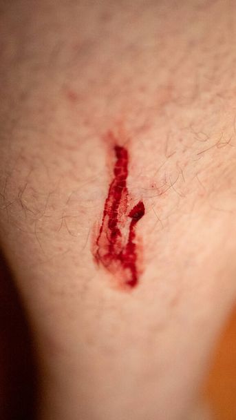 Uma pequena ferida na perna com sangue fluindo
. - Foto, Imagem