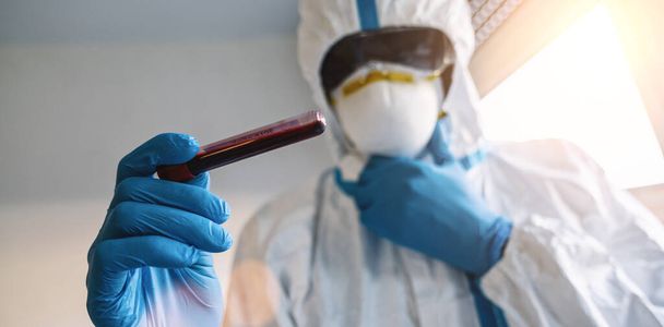 Médico em vestuário de protecção com amostra de sangue para o teste de anticorpos Covid-19 no laboratório
 - Foto, Imagem