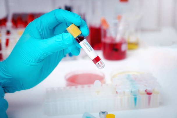 Researchers test blood samples in the laboratory. Researchers are inventing vaccines to treat COVID-19 virus. - Foto, imagen