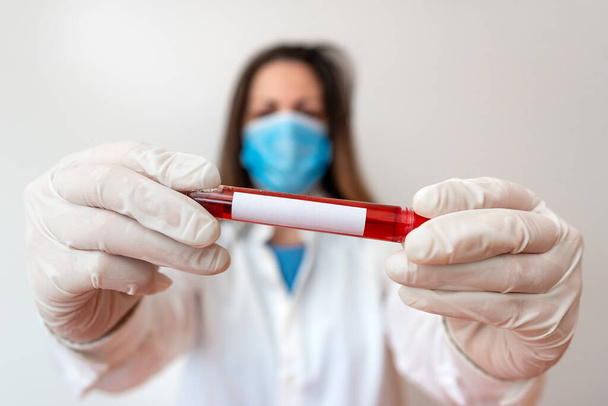 Henkilö, jolla on lääketieteelliset käsineet suorittavaan laboratoriokokeeseen. Holding Test Tube Of Blood For Health Kuntoanalyysi - Valokuva, kuva