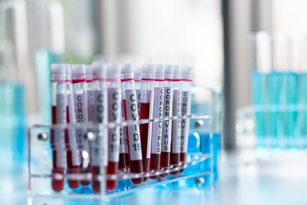 Bio Chemistry lab with blood test tubes closeup background. - Foto, afbeelding