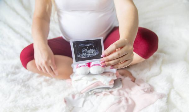 Egy terhes nő kezében van egy ultrahang képe. Szelektív fókusz. emberek. - Fotó, kép