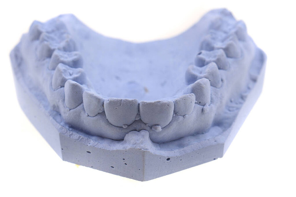 modelo de yeso de dientes aislado sobre el fondo blanco
 - Foto, Imagen