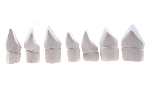 μοντέλα γύψου δοντιών που απομονώνονται στο λευκό φόντο - Φωτογραφία, εικόνα