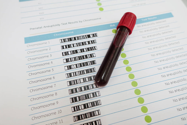 Blood for chromosome testing in laboratory - Foto, afbeelding