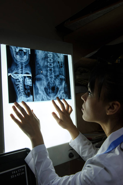 Omurilik röntgenini araştıran bir kadının resmi: bel ve boyun bölgesi - ilk 2 boyun omuru (eksen ve atlas), coxofemural eklem - Fotoğraf, Görsel