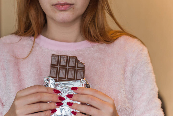 Mujer joven con problemas de acné comer barra de chocolate y dulces. Alergia a la piel. Concepto de problemas de la piel
 - Foto, imagen