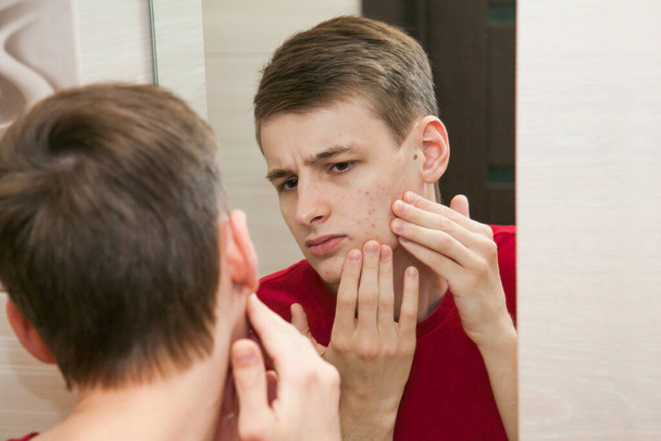 Close up of young attractive man with problematic skin and scars from acne looks in the mirror in the bathroom. - 写真・画像