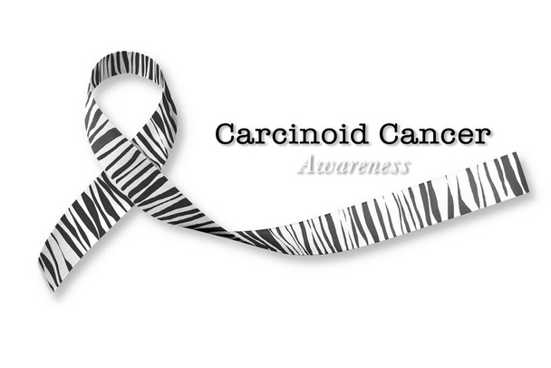 Καρκινοειδής Καρκίνος Ευαισθητοποίηση κορδέλα γραμμή ζέβρα μοτίβο εκτύπωσης απομονώνονται σε λευκό φόντο και απόκομμα διαδρομή - Φωτογραφία, εικόνα