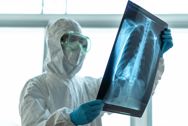 COVID-19 、コロナウイルスまたはPPEの医師または研究室技術者との新しいコロナウイルス流行病個人用保護具病院の研究室で肺胸部X線画像を保持 - 写真・画像