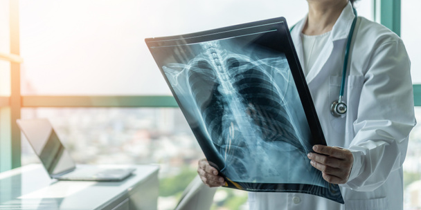 Doctor diagnosing patients health on asthma, lung disease, COVID-19 or bone cancer illness with radiological chest X-ray film for medical healthcare hospital service - Photo, image