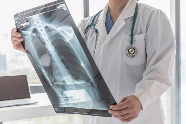 Doctor with radiological chest x-ray film for medical diagnosis on patients health on asthma, lung disease and bone cancer illness. - Foto, Imagem