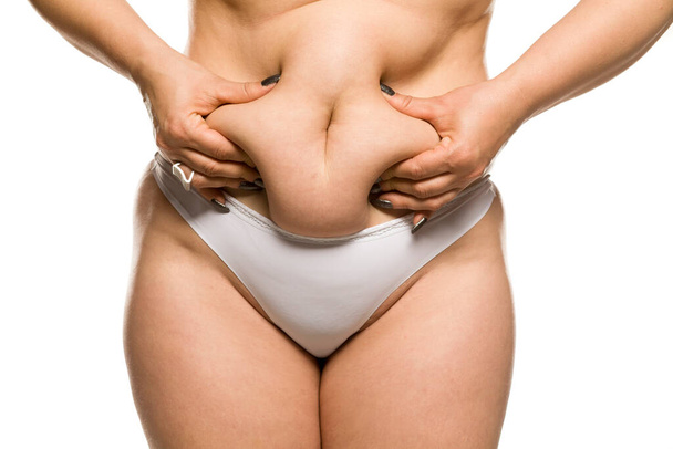 tlustá žena štípání břicho na bílém pozadí - Fotografie, Obrázek