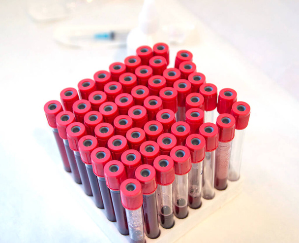 doctor with test tubes blood tubes for tests and experiments in the laboratory tests for coronavirus - Foto, Bild