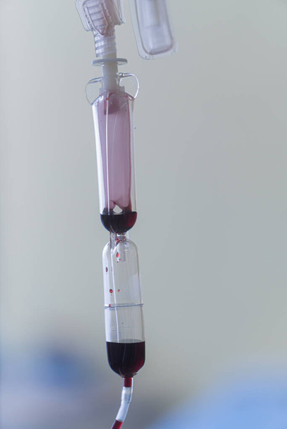 Ersatzblutbeutel aus dem medizinischen Labor, die an einer Stahlstange im Krankenhaus hängen, um Blut für die Venen der Patienten vorzubereiten, die in derselben Gruppe Blut spenden möchten - Foto, Bild
