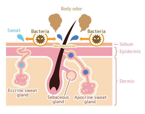 Cause of body odor vector flat illustration - Vector, Image